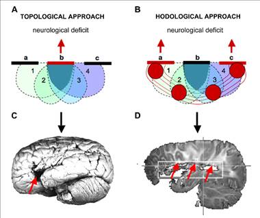 言語の神経基盤の伝統的モデル